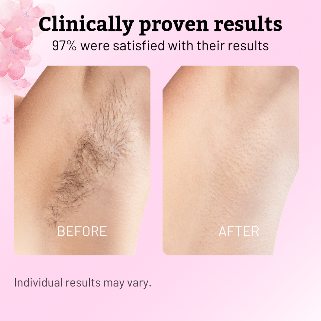 Cyperus Rotundus Oil - 60ml Natural Cyperus Rotundus Oil For Hair Removal, Moisturizing & Soothing Cyperus Oil For Reducing Body Hair Growth, Hair Removal Oil Ideal for All Skin Types